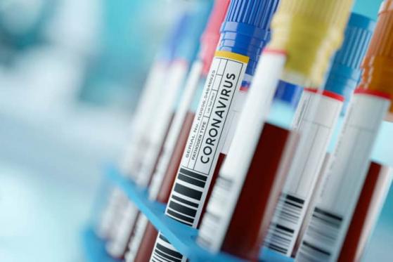 Impfstoff: Novavax-Aktie, Valneva-Aktie und AstraZeneca-Aktie mit 3 wichtigen News!